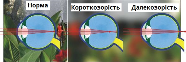Контактні лінзи з діоптріями